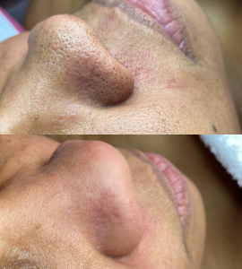 Lash Technician Service for EstheticX_by_Lamour