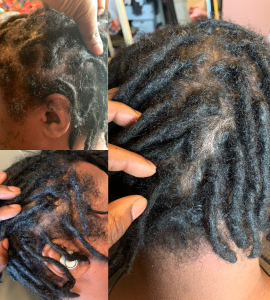 Loc Retwist for BlessedByRay