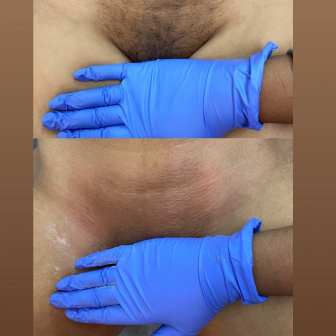 Lash Technician Service for EstheticX_by_Lamour